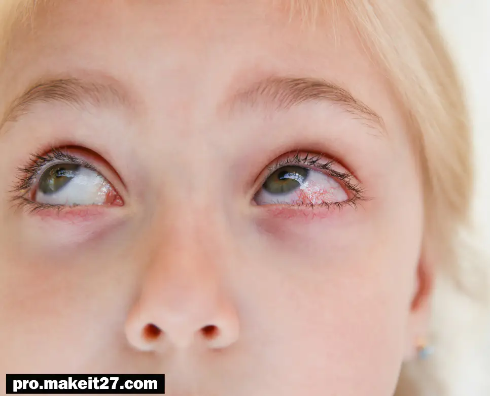 결막염 원인, 증상, 전염 경로와 효과적인 치료 방법