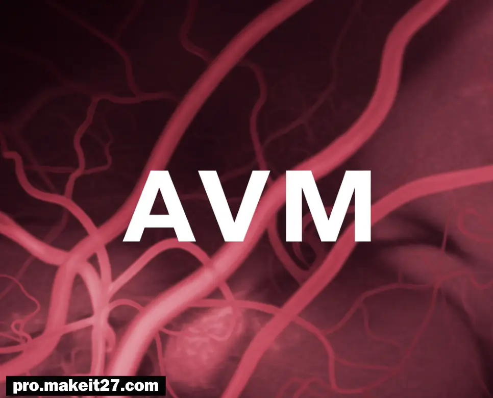 AVM 의학용어