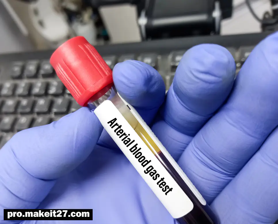 ABG 의학용어