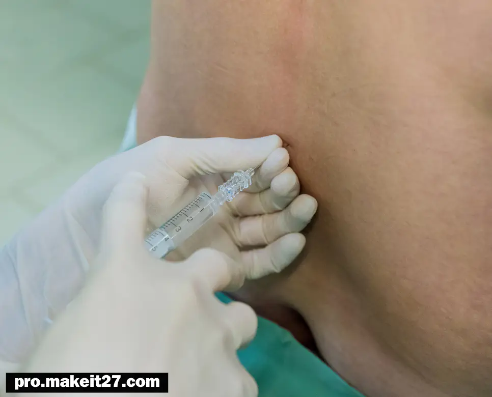 LP 의학용어, WBC 의학용어, TBI 의학용어 LP 의학용어, WBC 의학용어, TBI 의학용어