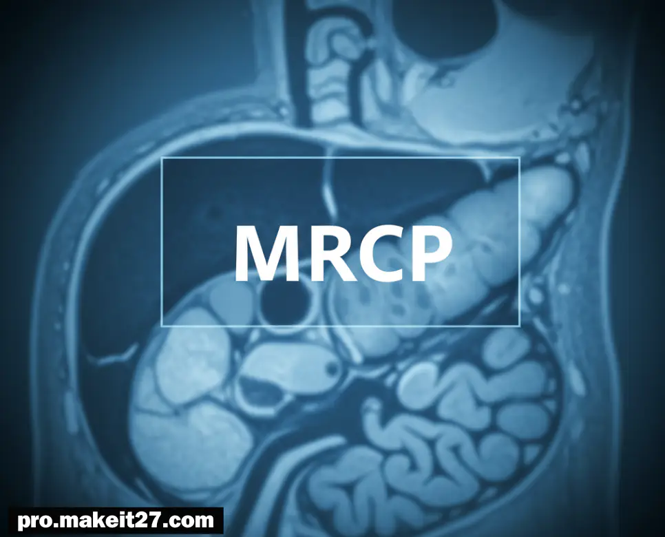 MRCP 의학용어