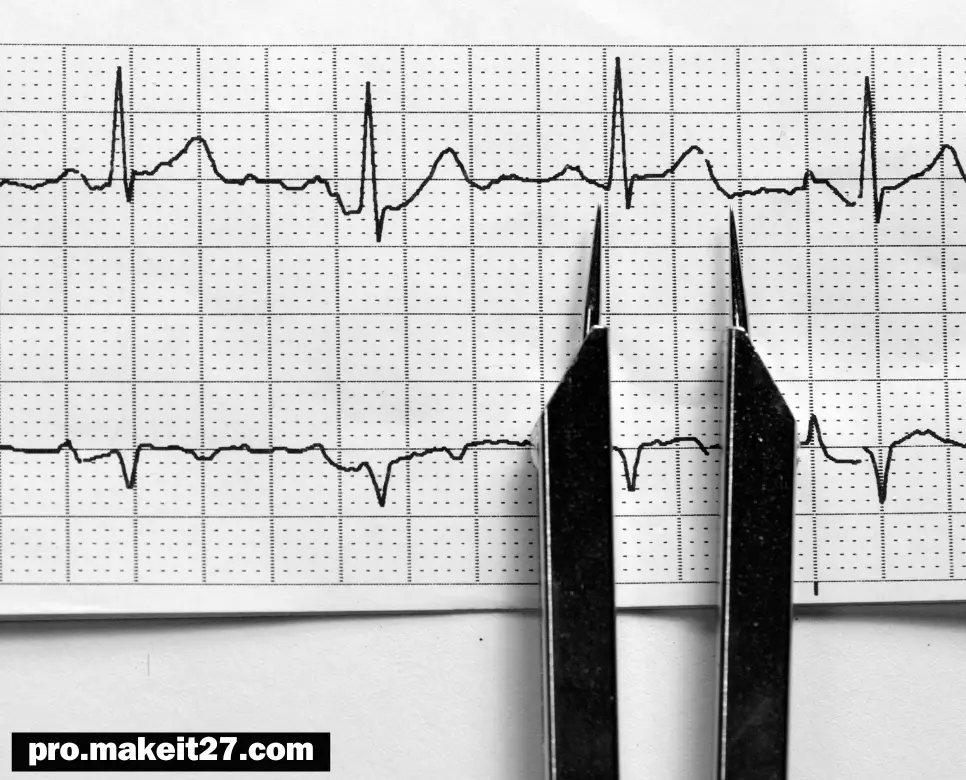 NSR 의학용어, CABG 의학용어, UA 의학용어 NSR 의학용어, CABG 의학용어, UA 의학용어