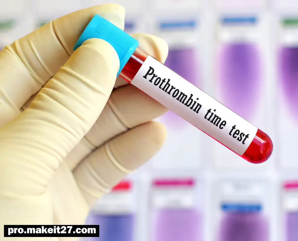 PT 의학용어, RBC 의학용어, IBS 의학용어 PT 의학용어, RBC 의학용어, IBS 의학용어