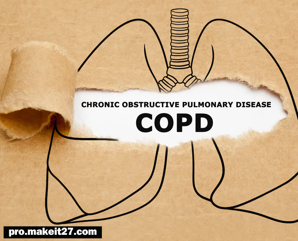 COPD 의학용어