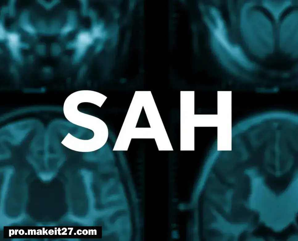 SAH 의학용어, NU 의학용어, R/O 의학용어