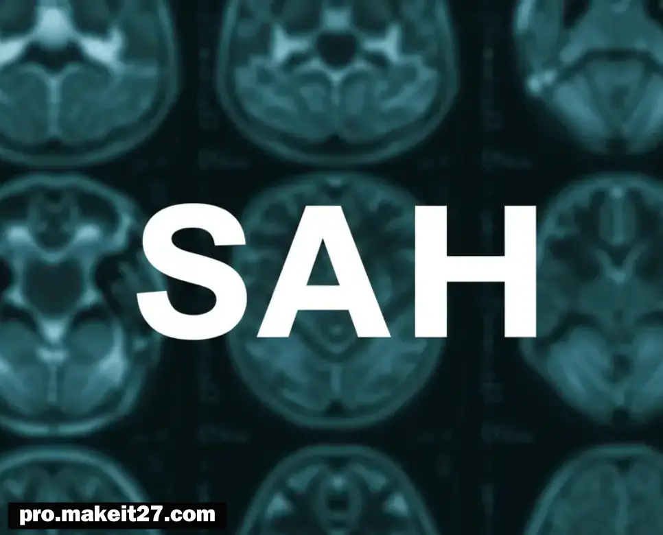 SAH 의학용어