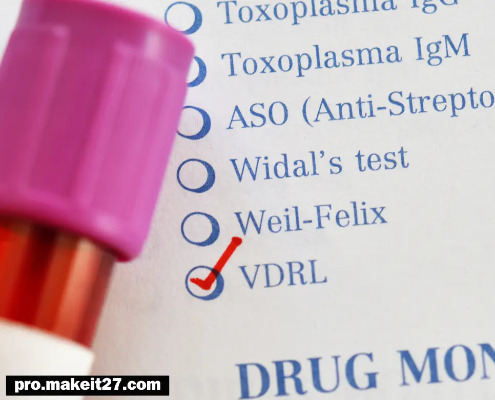 VDRL 의학용어